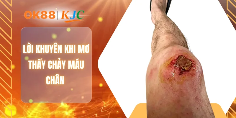 Lời khuyên khi mơ thấy chảy máu chân