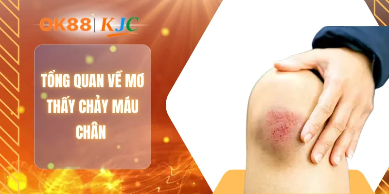 Tổng quan về mơ thấy chảy máu chân